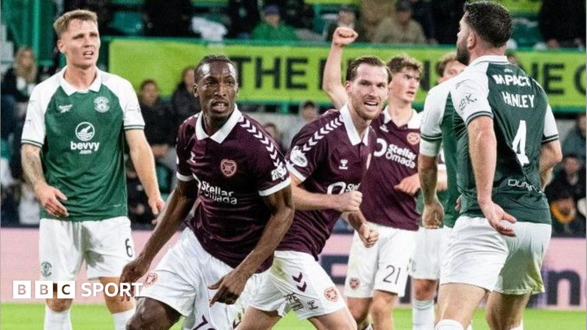 Edinburgh Derbisi: David Gray ve Wouter Vrancken Karşı Karşıya